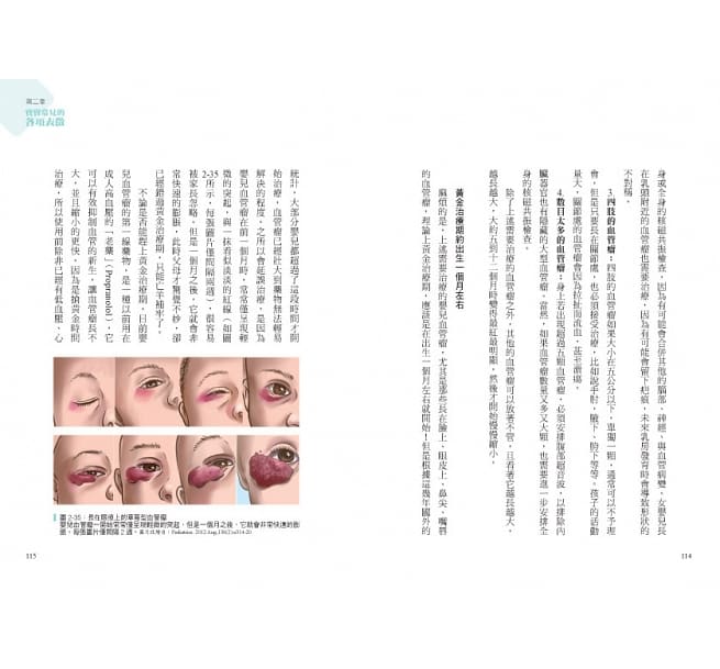 輕鬆當爸媽，孩子更健康 超人氣小兒科醫師黃瑽寧教你安心育兒暢銷增訂版